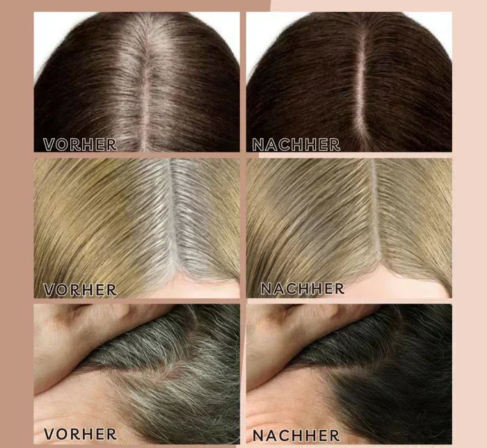 Perfekte Haarlinien jederzeit | 1+1 GRATIS