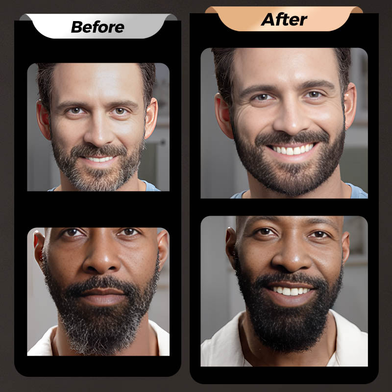 BeardPen Pro™ – 4-Spitzen Bart-Korrekturstift | 1+2 GRATIS