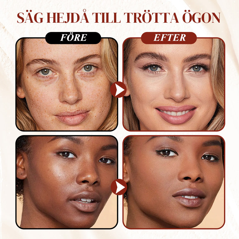 PureCeal – Sofort strahlende Augen ohne dunkle Ringe!