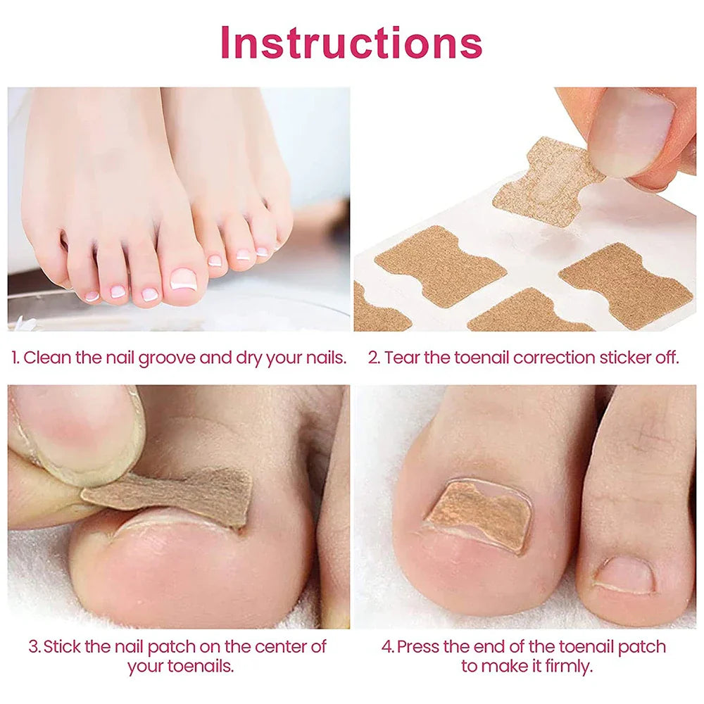 NagelVital Pro - Pflegeaufkleber für Nagelkorrekturen | 50% RABATT