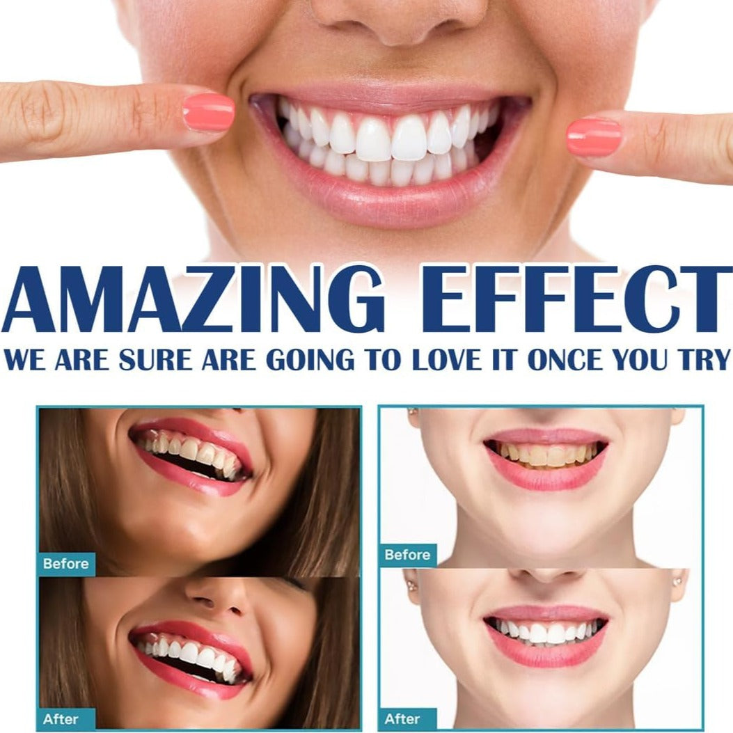 BrightSmile™ Zahnaufhellungs-Stift | 1+1 GRATIS