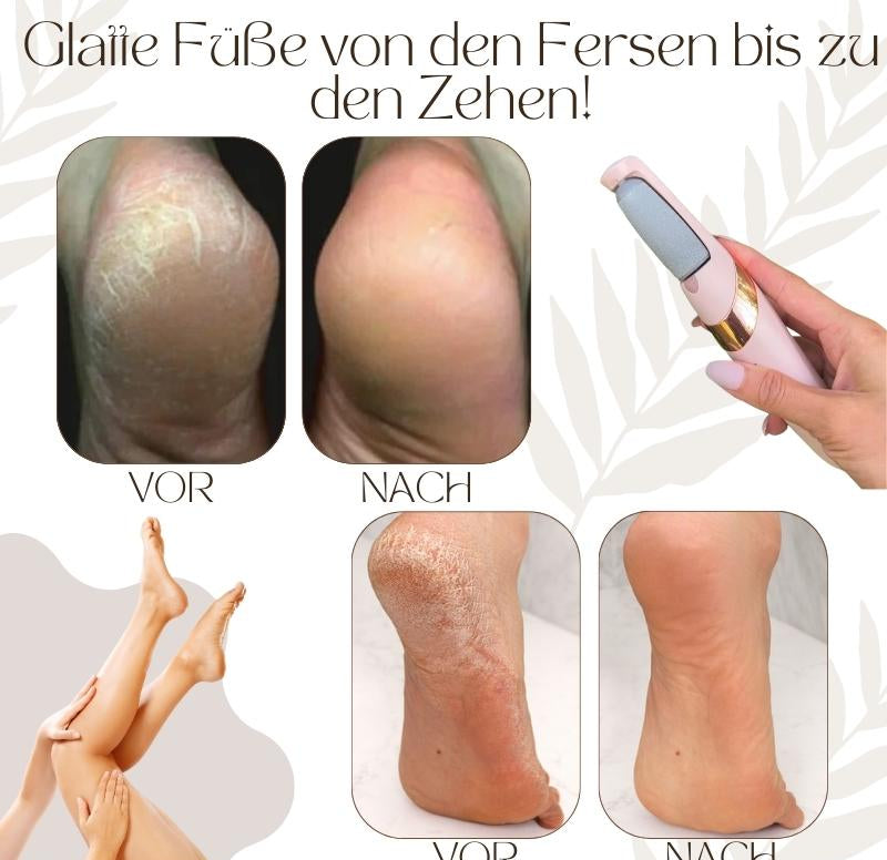 Elektrische Hornhautentferner