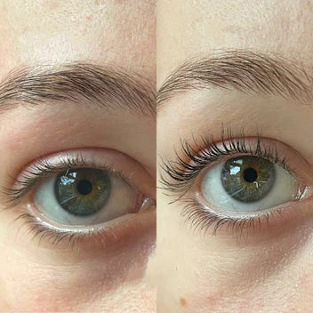 Lashy™ Für die schönsten natürlichen Wimpern |  1+1 GRATIS