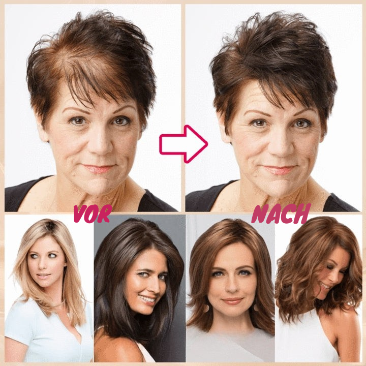 LumiHair – Natürlich wirkender Haar-Topper | 1 + 2 Gratis