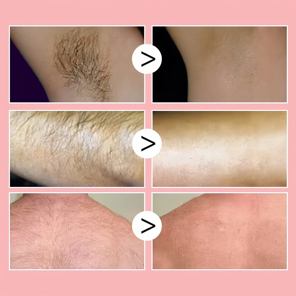 1+1 GRATIS | 100ml Honey Mousse Hair Removal Spray™ – Für eine makellose und haarfreie Haut!