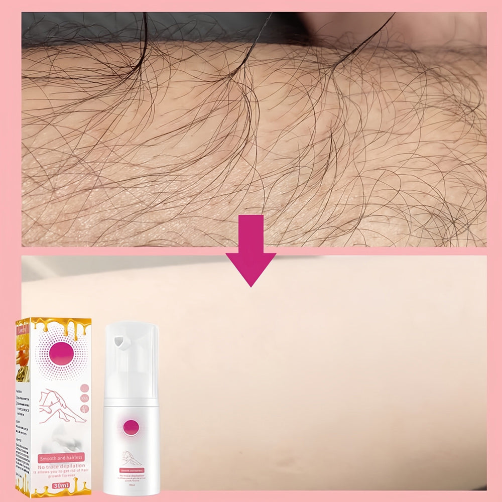 1+1 GRATIS | 100ml Honey Mousse Hair Removal Spray™ – Für eine makellose und haarfreie Haut!