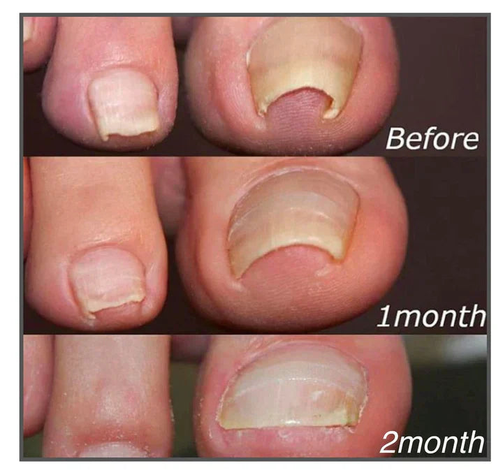 Sofortige Nagelreparatur
