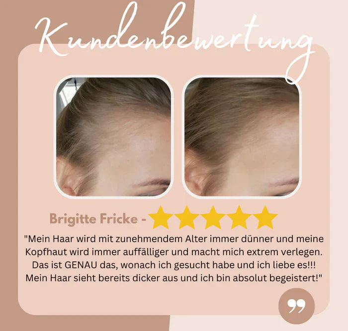 Perfekte Haarlinien jederzeit | 1+1 GRATIS