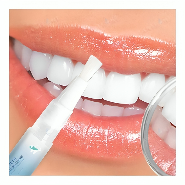 BrightSmile™ Zahnaufhellungs-Stift | 1+1 GRATIS