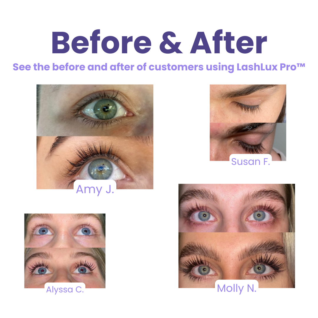 LashVital Pro - Wimpernwuchs-Serum | 1+1 GRATIS