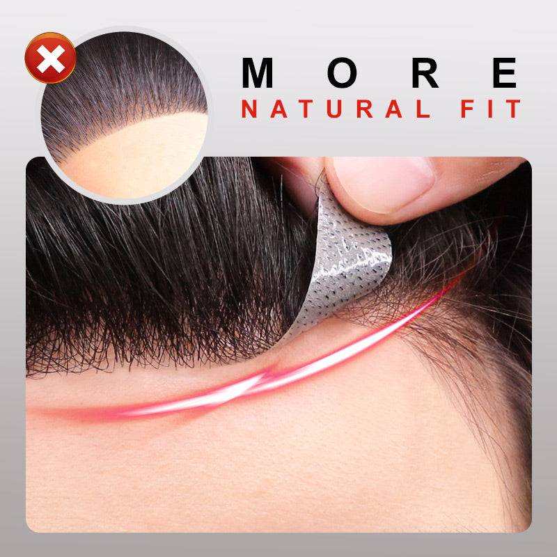 InvisiHair™ Männer-Stirnhaar-Toupet Soforthilfe