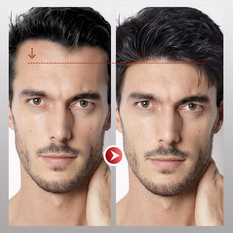 InvisiHair™ Männer-Stirnhaar-Toupet Soforthilfe