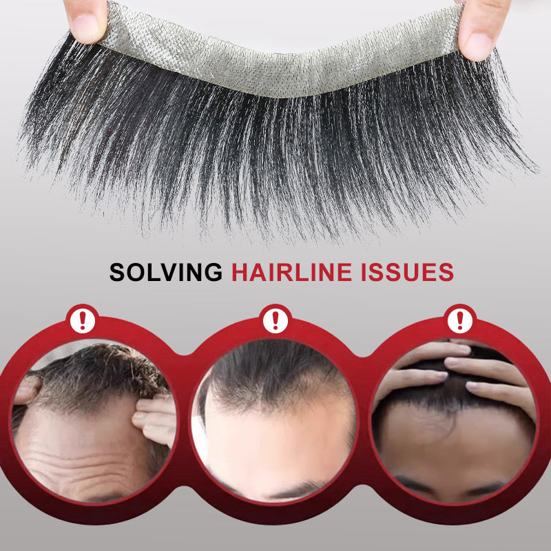 InvisiHair™ Männer-Stirnhaar-Toupet Soforthilfe