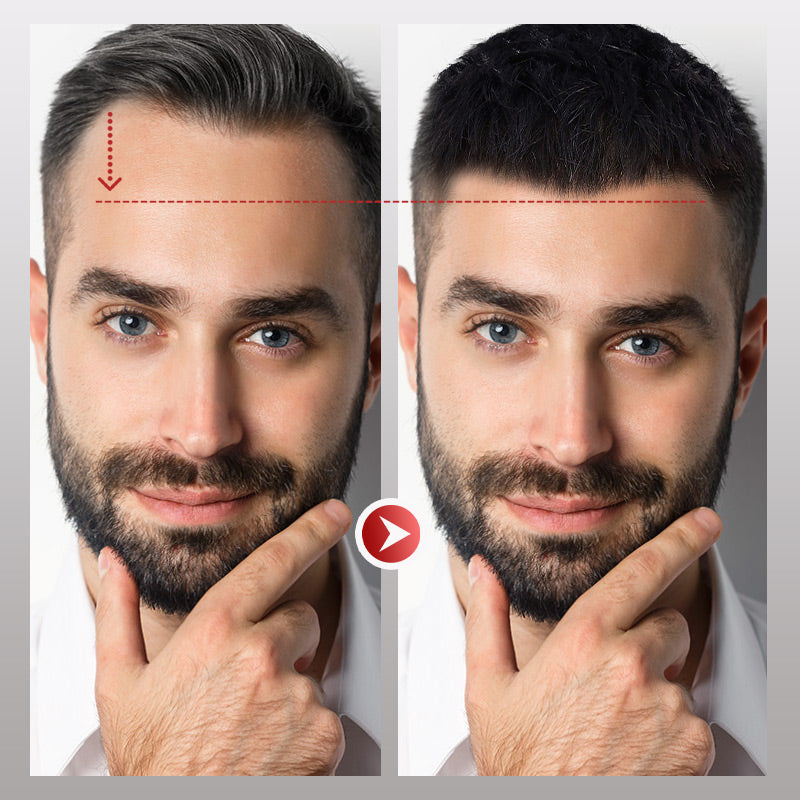 InvisiHair™ Männer-Stirnhaar-Toupet Soforthilfe