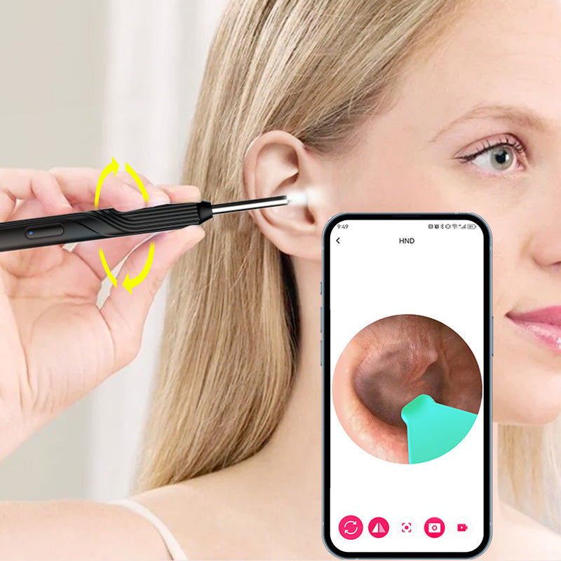 ClearScope™ Ohrenschmalz-Entferner mit HD-Kamera