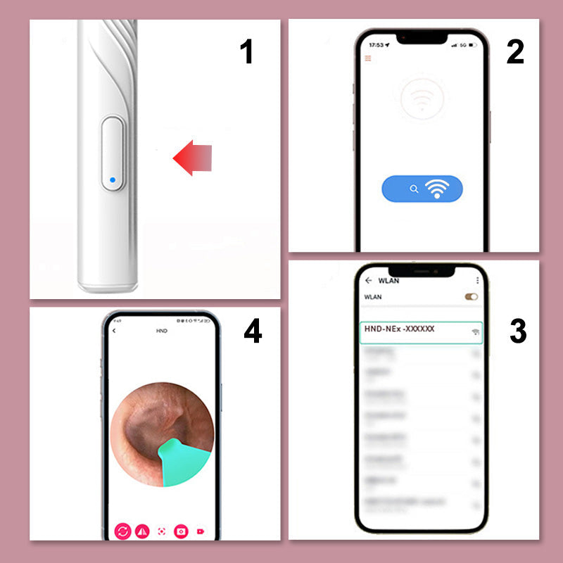 ClearScope™ Ohrenschmalz-Entferner mit HD-Kamera