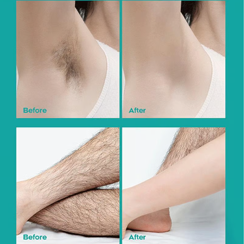 PainlessLux® Ganzkörper-Haarentfernungscreme | 1+1 GRATIS