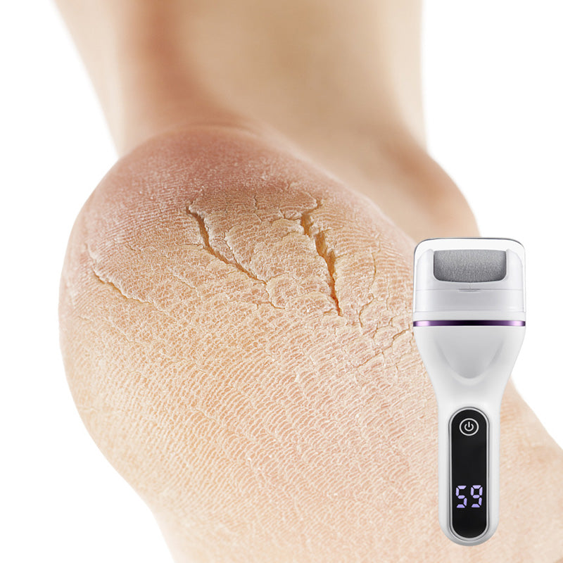 SmoothStep™ Elektrischer Fußschwielenentferner – Sanfte & Effektive Hornhautentfernung überall