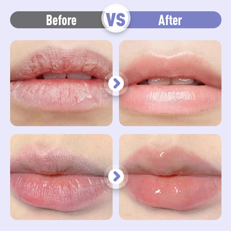 LumiLips™ – Aufpolsterndes & Anti-Falten Lippenserum | 1+2 GRATIS