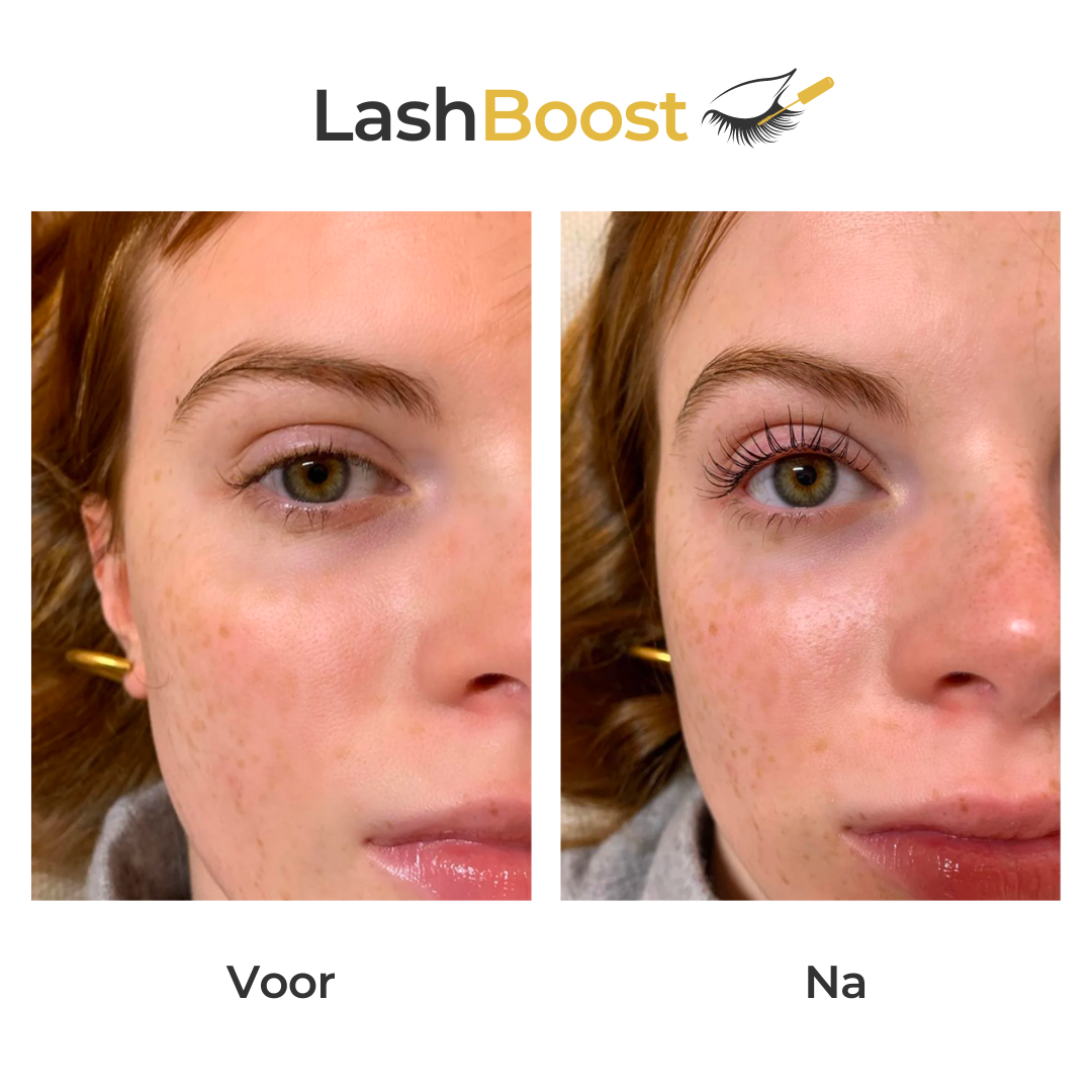 Lash Booster ™ | Wimpernwachstumsserum | 1+1 GRATIS Begrenztes Angebot