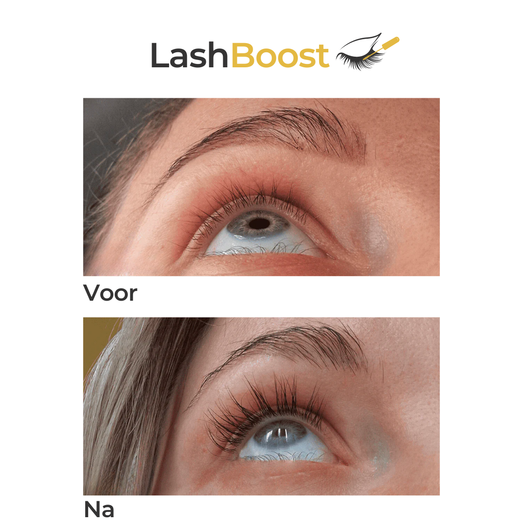 Lash Booster ™ | Wimpernwachstumsserum | 1+1 GRATIS Begrenztes Angebot